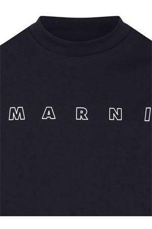  MARNI KIDS | M01466M00RF0M803